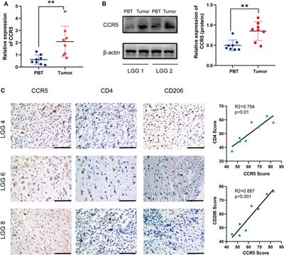 CCR5 as a Prognostic Factor in Lower-Grade Glioma is Involved in the Remodeling of the Tumor Microenvironment